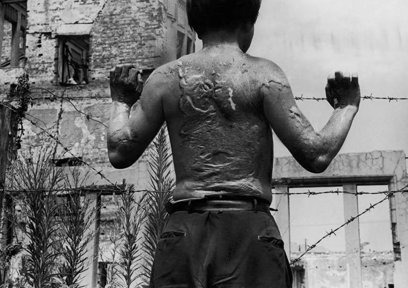 Các nạn nhân bom nguyên tử mít tinh trước thềm hội nghị giải trừ hạt nhân