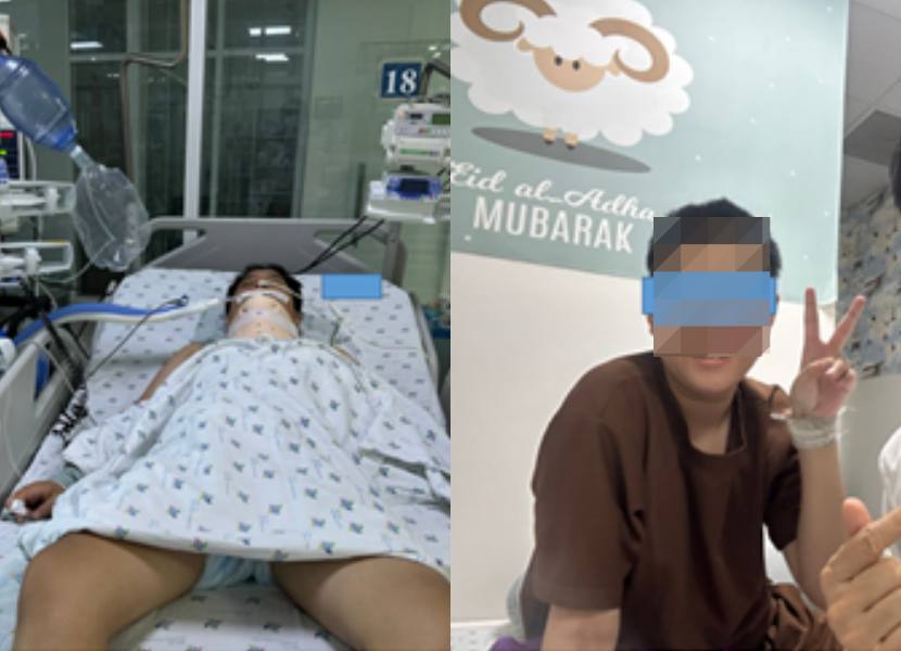 Nam sinh lớp 8 bị nhóm bạn đánh hội đồng đã hồi phục, không để lại di chứng