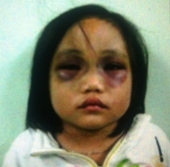 Những vụ bạo hành trẻ em kinh dị nhất Việt Nam