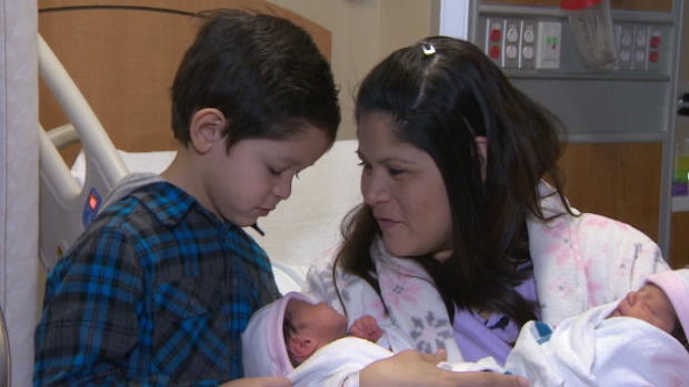 Cặp sinh đôi kỳ lạ khác năm sinh