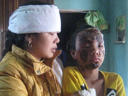 Khởi tố vụ nổ đài cassette khiến 3 người thương vong