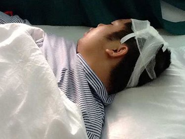 Đi đòi nợ, bị con nợ chém xẻ đầu