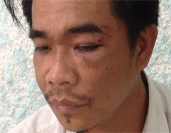 Giả làm khách đến chúc Tết để trộm túi