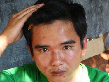 Thiếu úy công an bị tố đánh người nhập viện