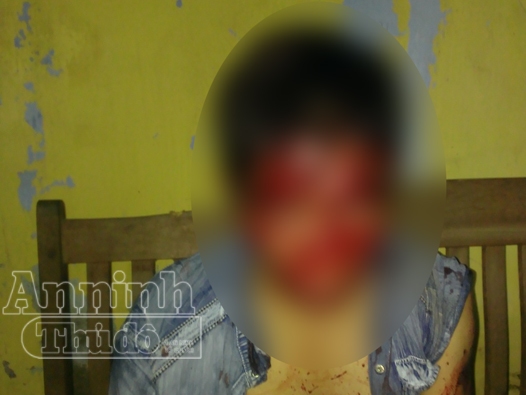 Mang súng giả đi đòi nợ, bị đánh suýt vong mạng