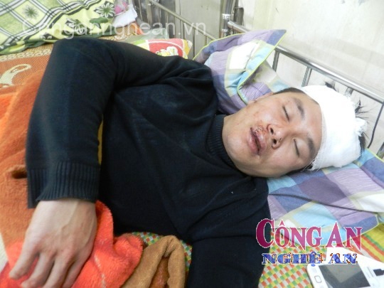 Nhập viện vì bị đánh hội đồng