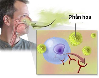 Ngăn ngừa dị ứng mùa xuân, cách gì