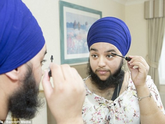 Cô gái mọc râu quai nón như đàn ông