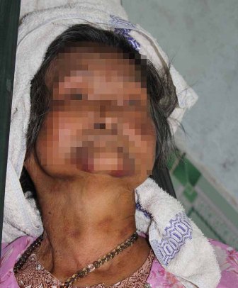 Cụ bà 80 bị yêu râu xanh 23 tuổi làm nhục