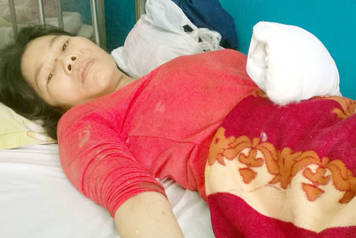 Thiếu phụ bán vé số bị chém trọng thương