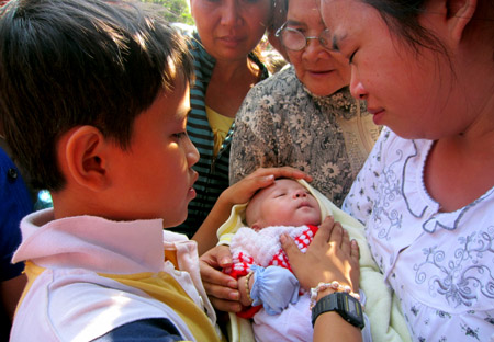 Em bé 1 tháng tuổi bị bệnh tim bẩm sinh nhưng