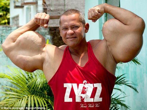 Phát sợ khi xem bắp tay dị dạng, khổng lồ