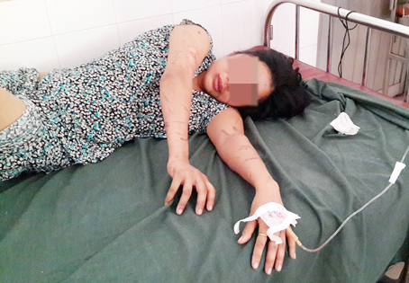 Một phụ nữ bị tra tấn dã man vì nghi ăn cắp laptop