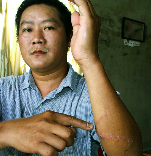 Hậu vụ nổ súng kinh hoàng tại đám tang