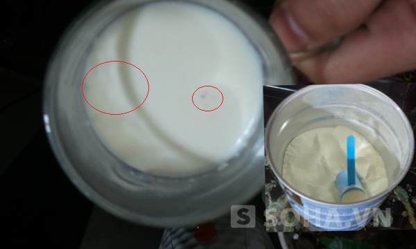 Sữa nổi váng đen Sự im lặng khó hiểu của Abbott với khách hàng