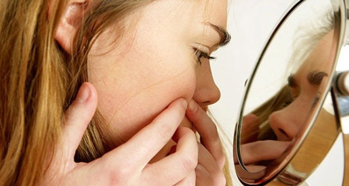 7 lý do khiến da bạn mãi bị mụn