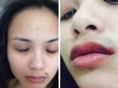 Lộ ảnh Diễm Hương bị chồng đại gia hành hung