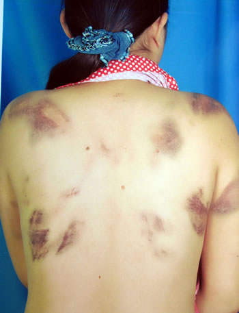 Những người vợ bị bạo hành