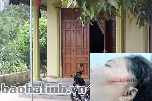 Bố chồng chém con dâu nhập viện