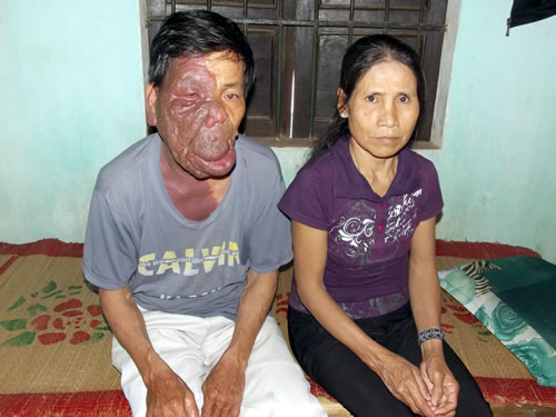 Có một tình yêu như thế