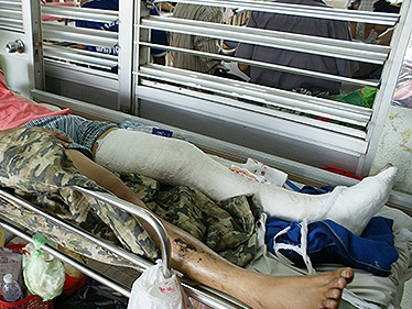 Khởi tố đối tượng đánh gãy chân người yêu của con gái