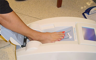 Bệnh loãng xương