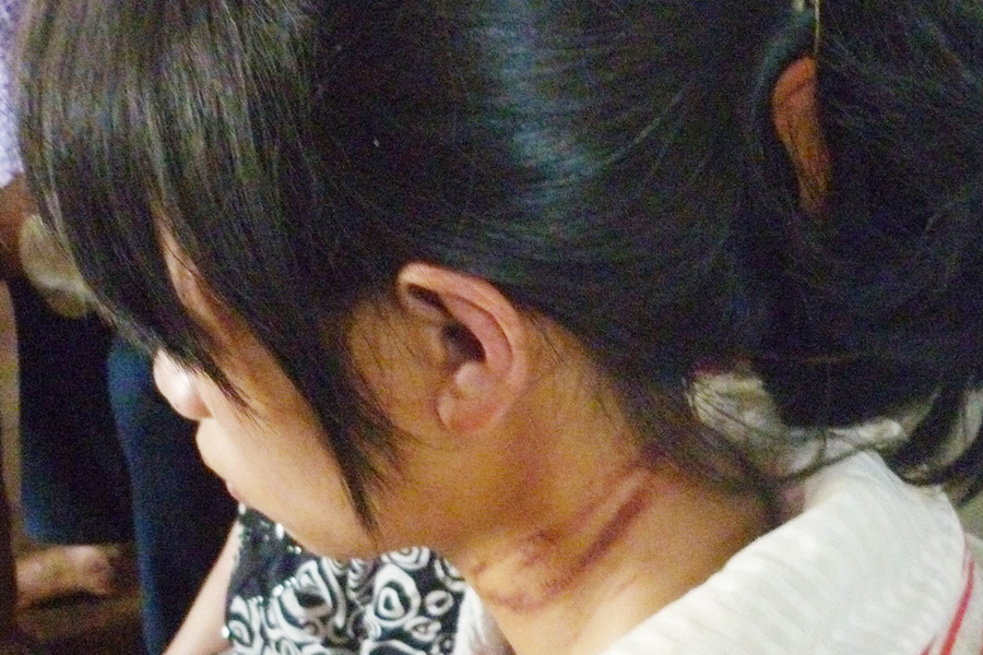 Bị mẹ ruột hành hạ dã man, thiếu nữ uống thuốc tự tử