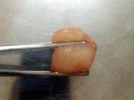 Hà Nội Hóc vải, bé trai 6 tuổi tử vong thương tâm