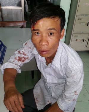 Tuần tra bắt trộm