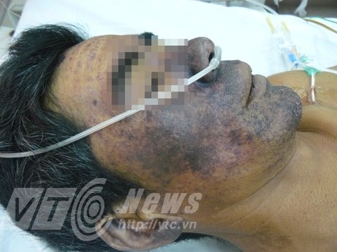 Ăn tiết canh dê, doanh nhân sắp mất mạng