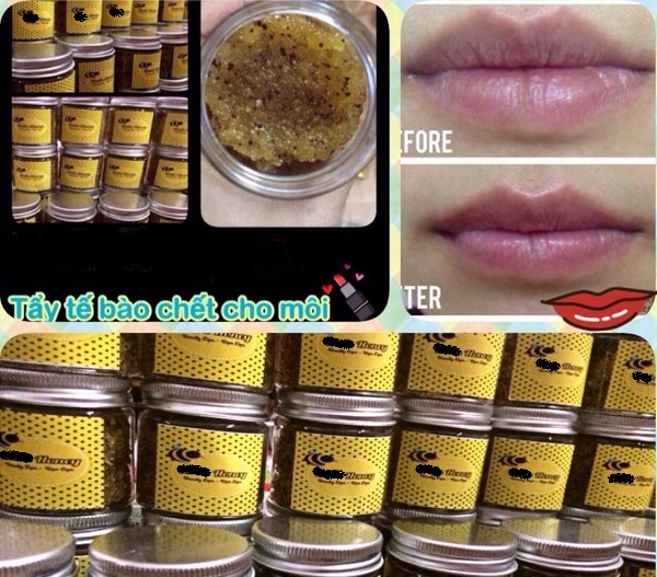 Dị ứng, sưng môi vì dùng kem tẩy da chết handmade