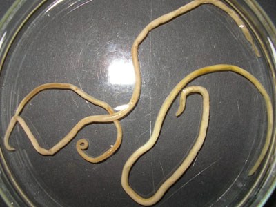 Ăn thịt chó, bị giun đũa đóng tổ phá nát não, gan