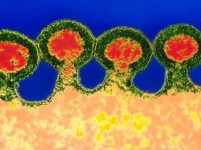 Đã tìm ra khắc tinh của virus HIV