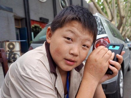 Ế vì sở hữu khuôn mặt trẻ con