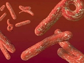 Phòng tránh virus Ebola bằng cách nào