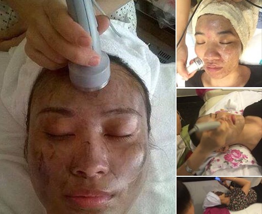 Công nghệ hút chì cho da chỉ là   chém gió