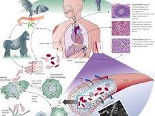 3 phương án ứng phó dịch Ebola của Bộ Y tế