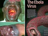 Đại dịch Ebola – cơn ác mộng của toàn cầu