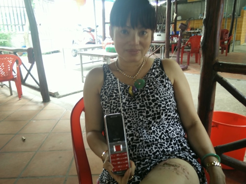 Điện thoại Trung Quốc phát nổ khiến một phụ nữ bị bỏng Vì sao