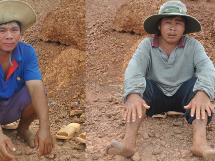 Kỳ lạ 2 anh em cùng 6 ngón , cùng sở thích giống nhau