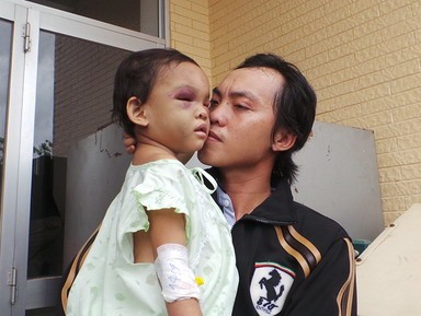 Khởi tố 2 đối tượng bạo hành trẻ em ở Bình Dương