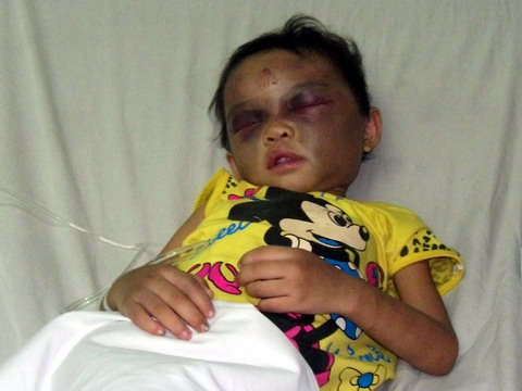 Trẻ em có nguy cơ bị bạo hành ở bất cứ môi trường nào