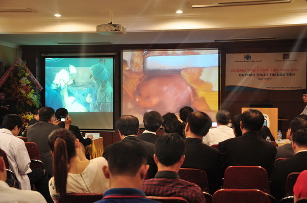 Dự án mổ tim nghìn tỉ và doanh nhân Huỳnh Uy Dũng