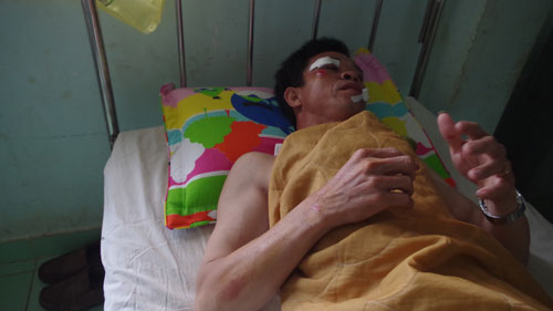 Bắt tổng giám đốc dùng súng bắn đạn cao su bắn người