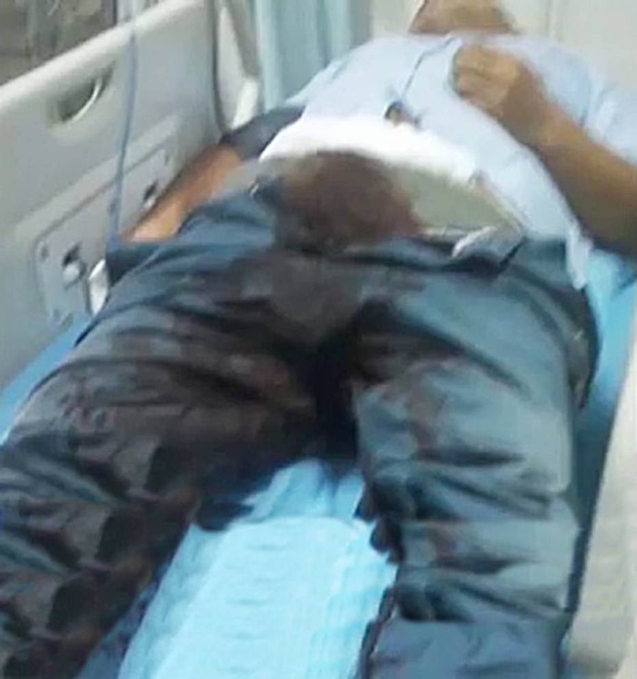 Bị bạn gái đá , nam sinh tự cắt cậu nhỏ ném vào thùng rác