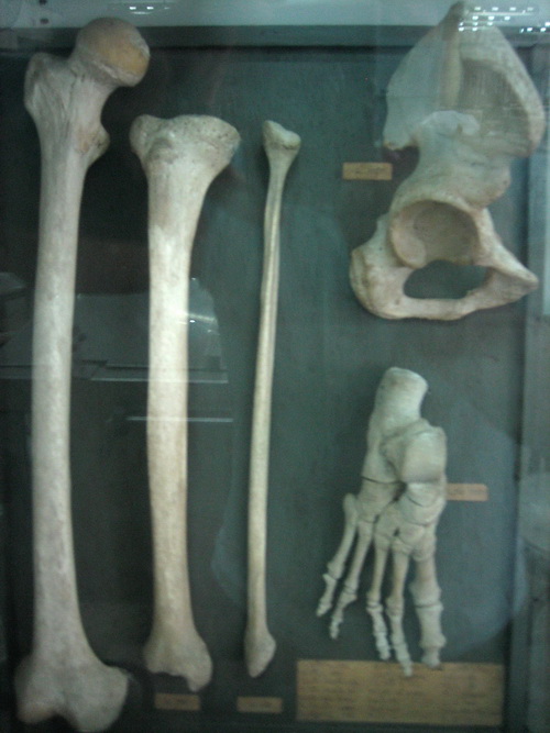 Hẩm hiu nghề thu gom… xác