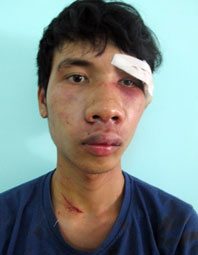 Người dân bắt cướp