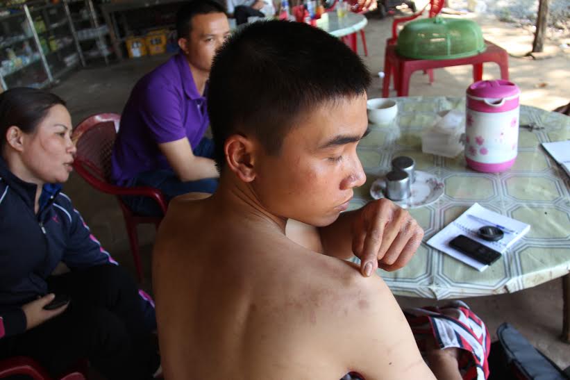 Điều tra vụ người làm công tại cây xăng nghi bị chủ hành hung