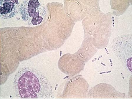 Nguy cơ lây lan dịch hạch vào Việt Nam rất lớn