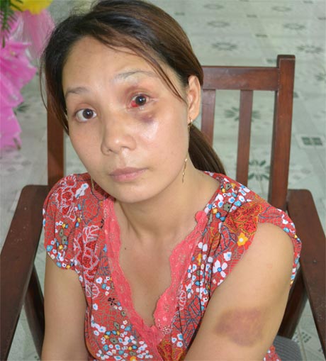 Trên 71 nạn nhân của bạo lực gia đình là phụ nữ, trẻ em gái